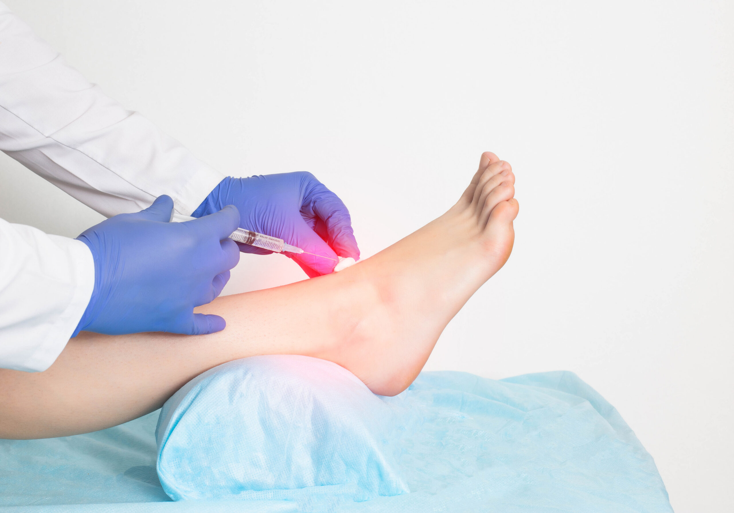 The doctor gives an intra-articular injection of an ankle block to a patient who has a ligament rupture and injury, close-up. Ozone therapy